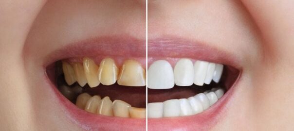 cosmetic dentistry